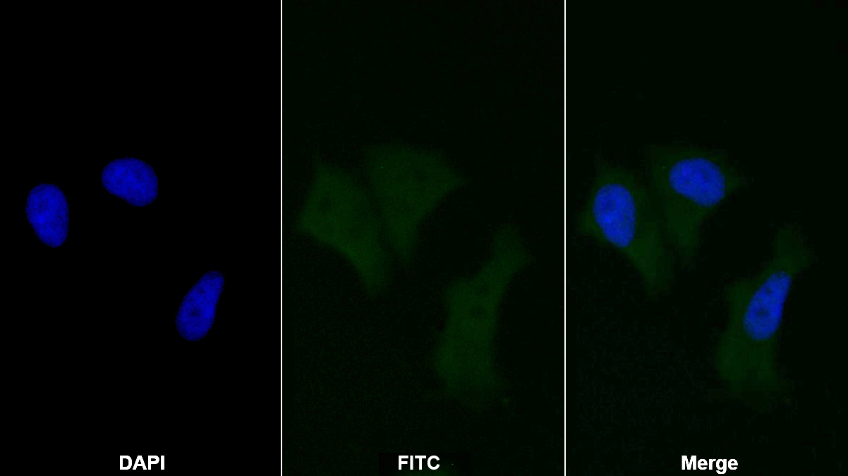 Polyclonal Antibody to Phospholipase A2 Activating Protein (PLAP)