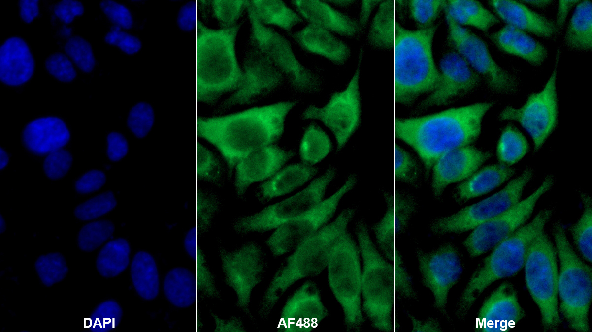 Polyclonal Antibody to Phospholipase A2 Activating Protein (PLAP)