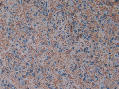 Polyclonal Antibody to Aquaporin 1 (AQP1)