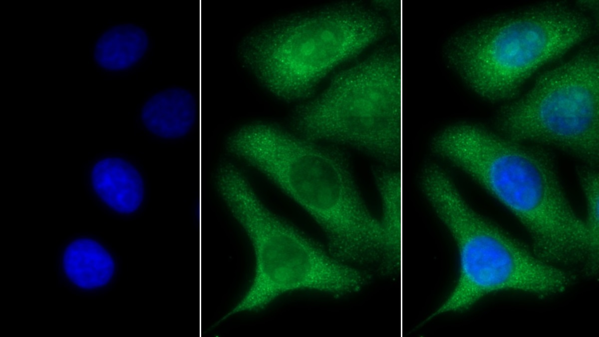 Polyclonal Antibody to Aquaporin 1 (AQP1)