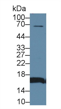 Polyclonal Antibody to Aquaporin 2, Collecting Duct (AQP2)