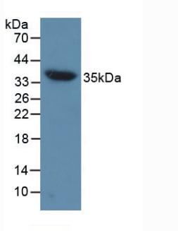 Polyclonal Antibody to Aquaporin 4 (AQP4)