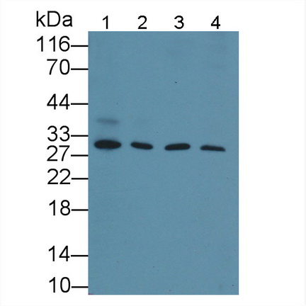 Polyclonal Antibody to Cyclin D1 (CCND1)