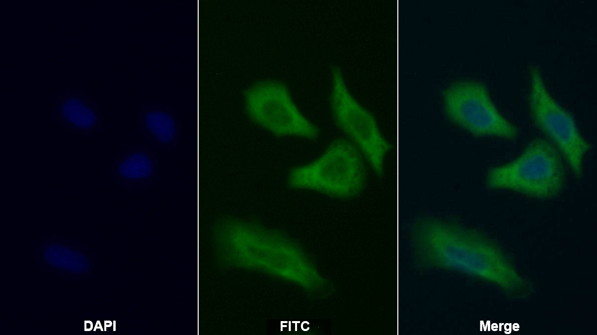 Polyclonal Antibody to Pyruvate kinase isozymes M2 (PKM2)