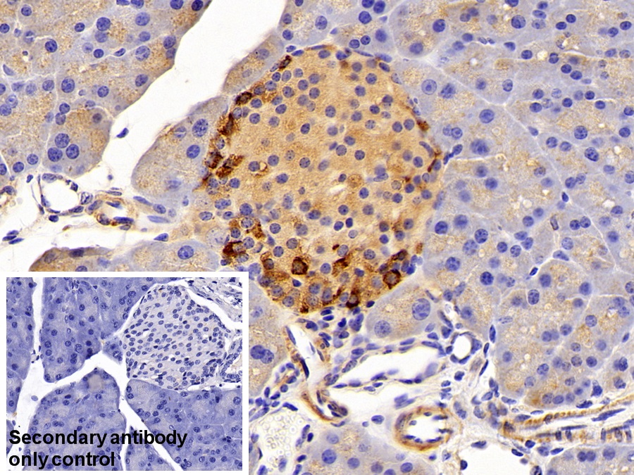 Polyclonal Antibody to Somatostatin (SST)