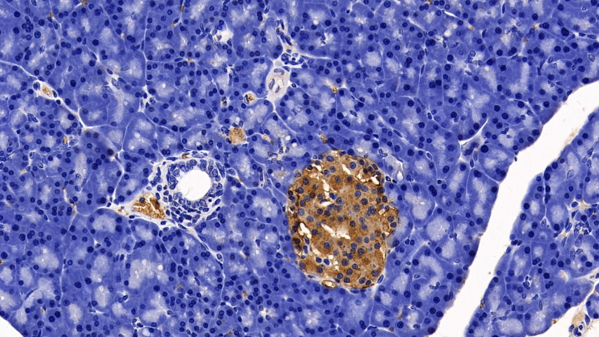 Polyclonal Antibody to Somatostatin (SST)