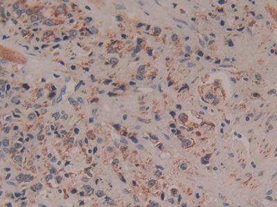 Polyclonal Antibody to Cytochrome C (CYCS)