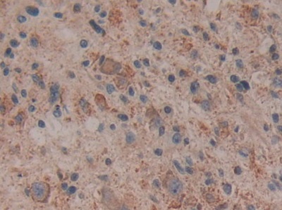 Polyclonal Antibody to Cytochrome C (CYCS)