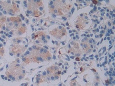 Polyclonal Antibody to Granzyme B (GZMB)