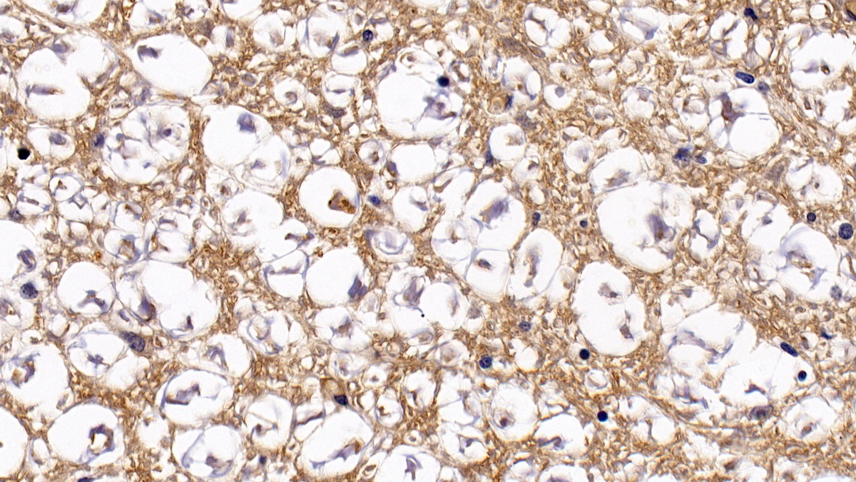 Polyclonal Antibody to Granzyme B (GZMB)