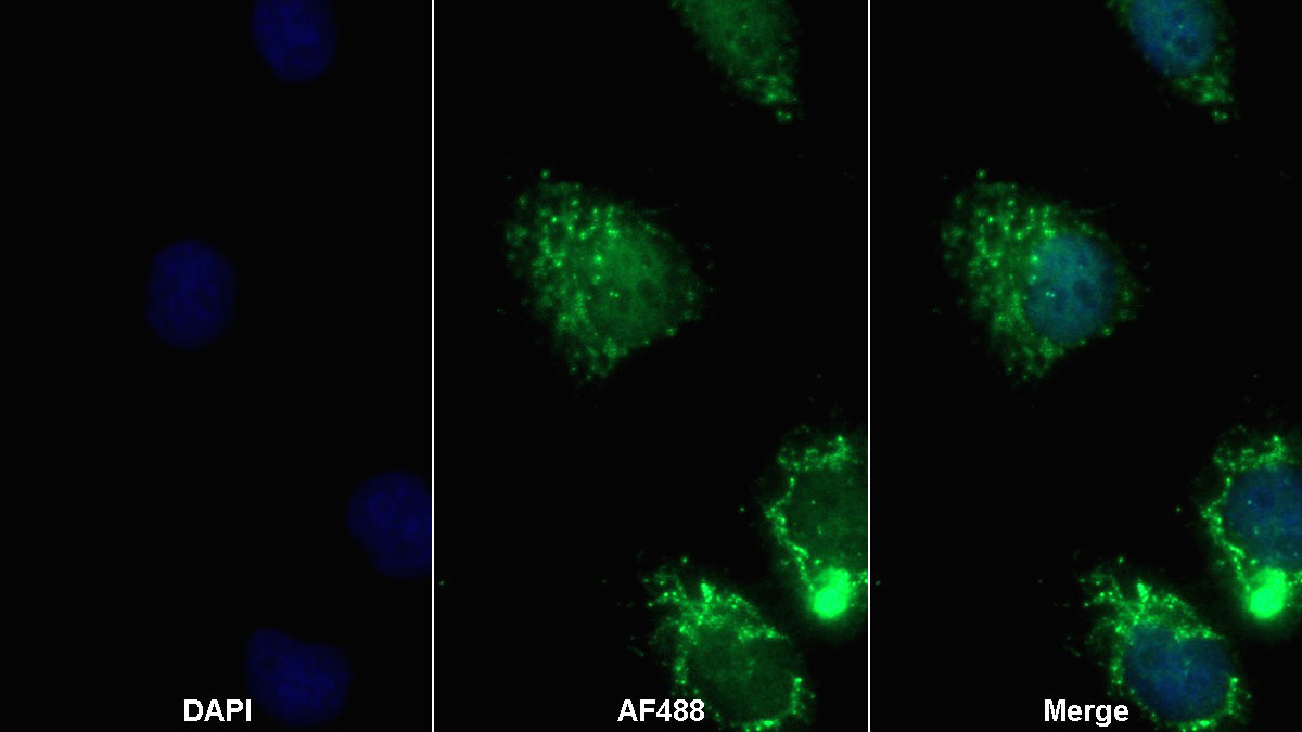 Polyclonal Antibody to Adiponectin (ADPN)