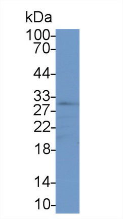 Polyclonal Antibody to Adiponectin (ADPN)