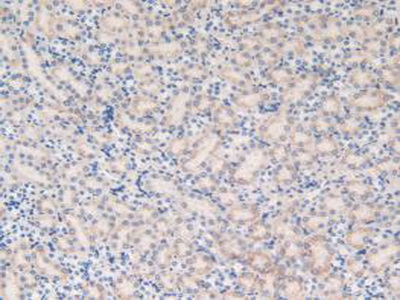 Polyclonal Antibody to Microsomal Glutathione S Transferase 1 (MGST1)