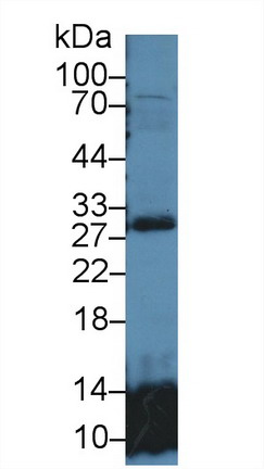 Polyclonal Antibody to Glutathione S Transferase Theta 2 (GSTt2)