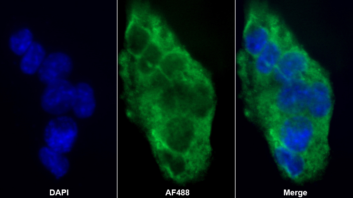 Polyclonal Antibody to Carboxypeptidase B2 (CPB2)