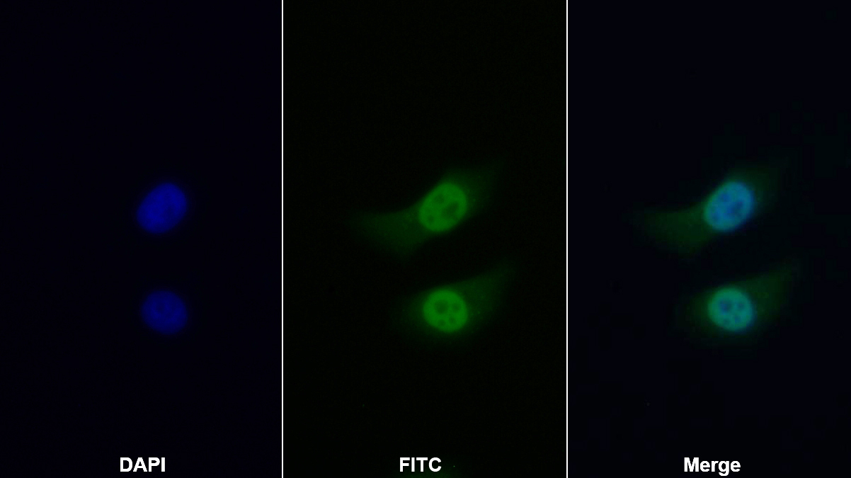 Polyclonal Antibody to Hepatoma Derived Growth Factor (HDGF)