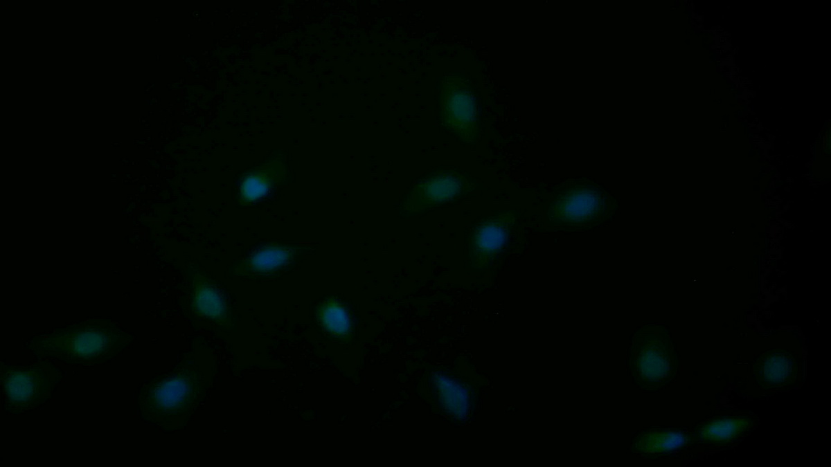 Polyclonal Antibody to Caspase 3 (CASP3)