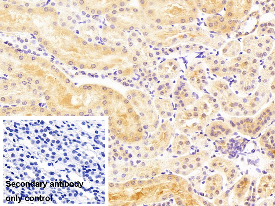 Polyclonal Antibody to Platelet Derived Growth Factor BB (PDGF BB)