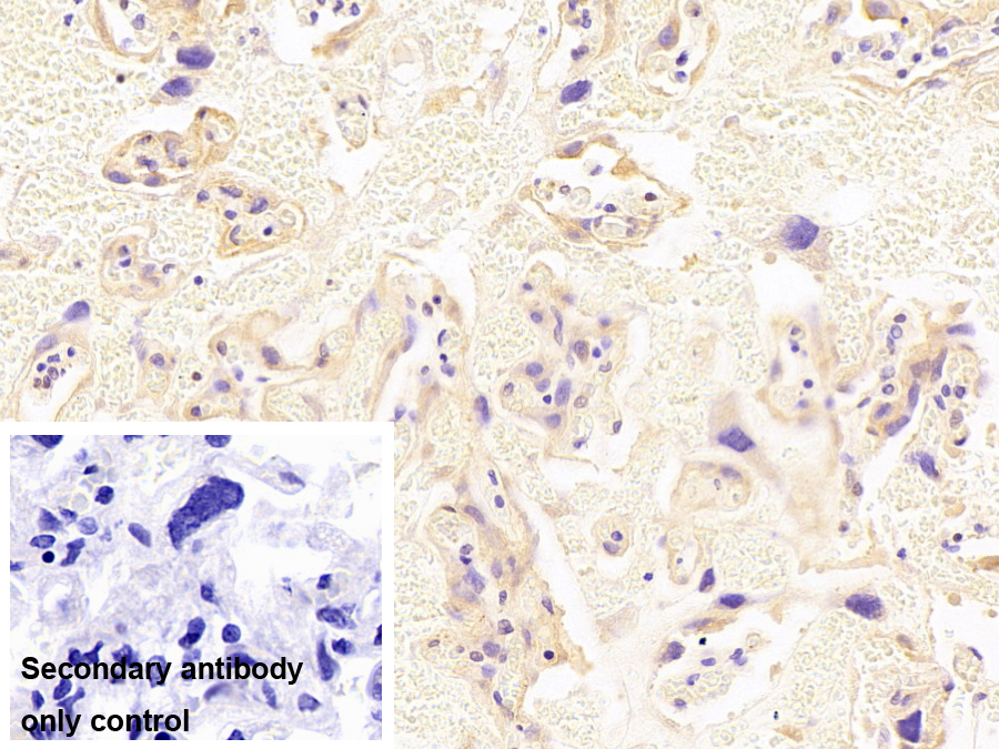 Polyclonal Antibody to Platelet Derived Growth Factor BB (PDGF BB)