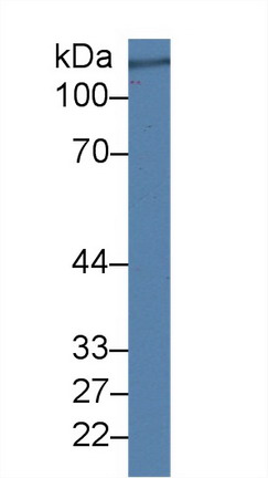 Polyclonal Antibody to Complement Factor H (CFH)