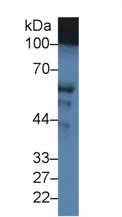 Polyclonal Antibody to Complement Factor H (CFH)