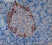 Polyclonal Antibody to Complement Factor H (CFH)