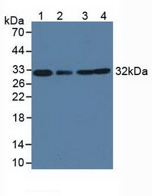 Polyclonal Antibody to Complement component 1 Q subcomponent-binding protein, mitochondrial (C1QBP)