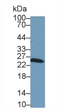 Polyclonal Antibody to Glutathione S Transferase Mu 1 (GSTM1)