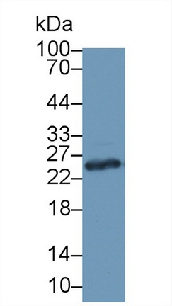 Polyclonal Antibody to Glutathione S Transferase Mu 1 (GSTM1)