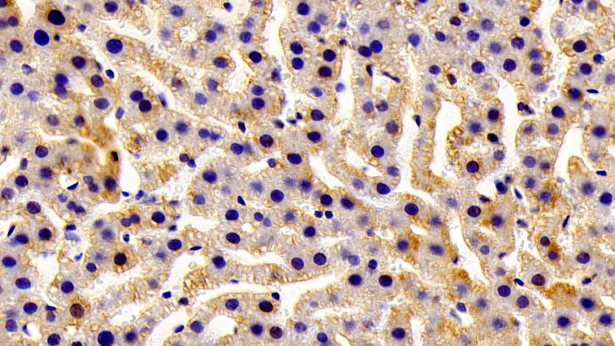 Polyclonal Antibody to Glutathione S Transferase Mu 1 (GSTM1)