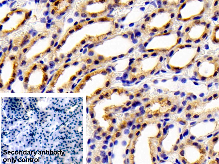 Polyclonal Antibody to Glutathione S Transferase Mu 1 (GSTM1)