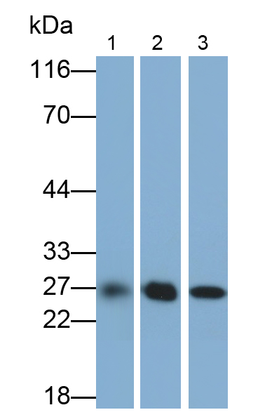 Polyclonal Antibody to Glutathione S Transferase Mu 1 (GSTM1)