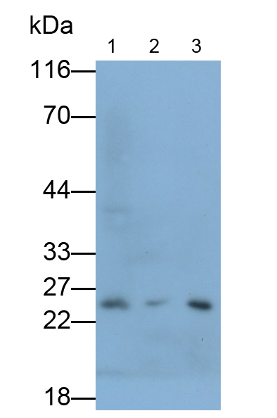 Polyclonal Antibody to Glutathione S Transferase A4 (GSTA4)