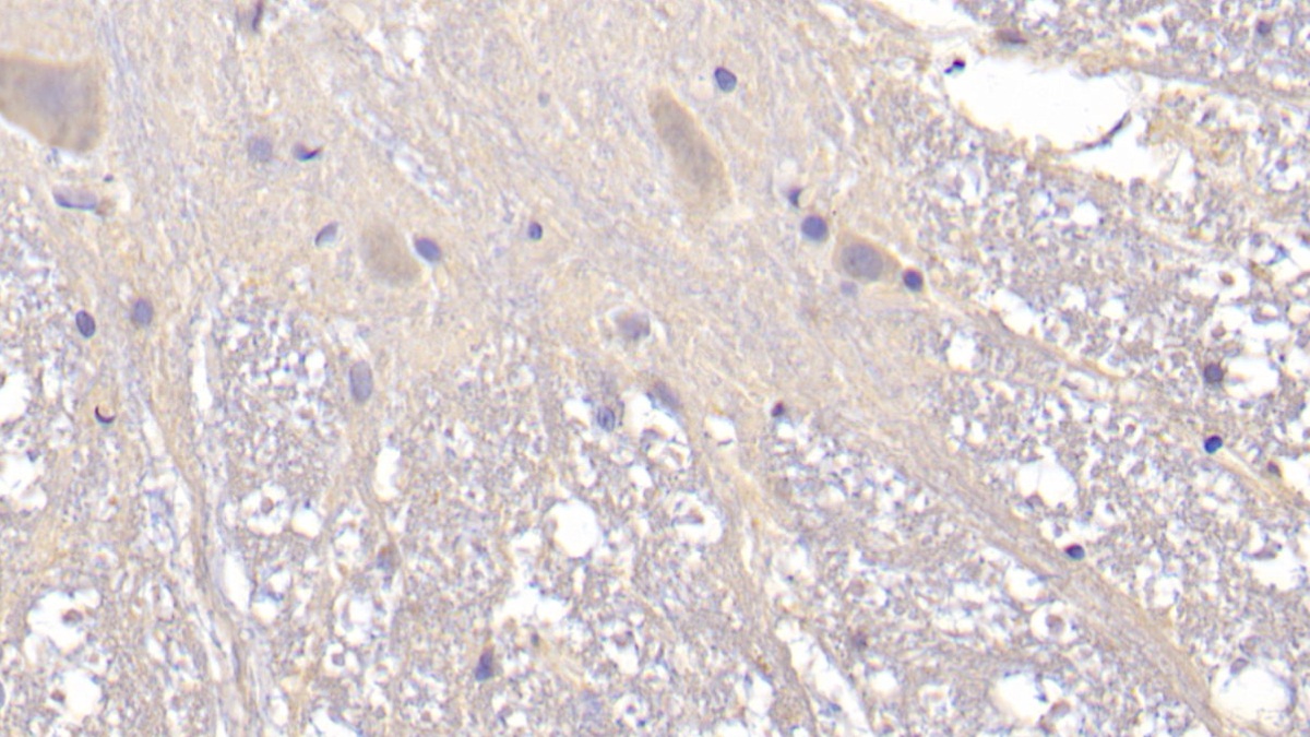 Polyclonal Antibody to Slit Homolog 2 (Slit2)