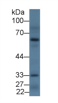 Polyclonal Antibody to Dopamine Receptor D2 (DRD2)