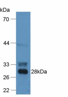 Polyclonal Antibody to Coagulation Factor XII (F12)