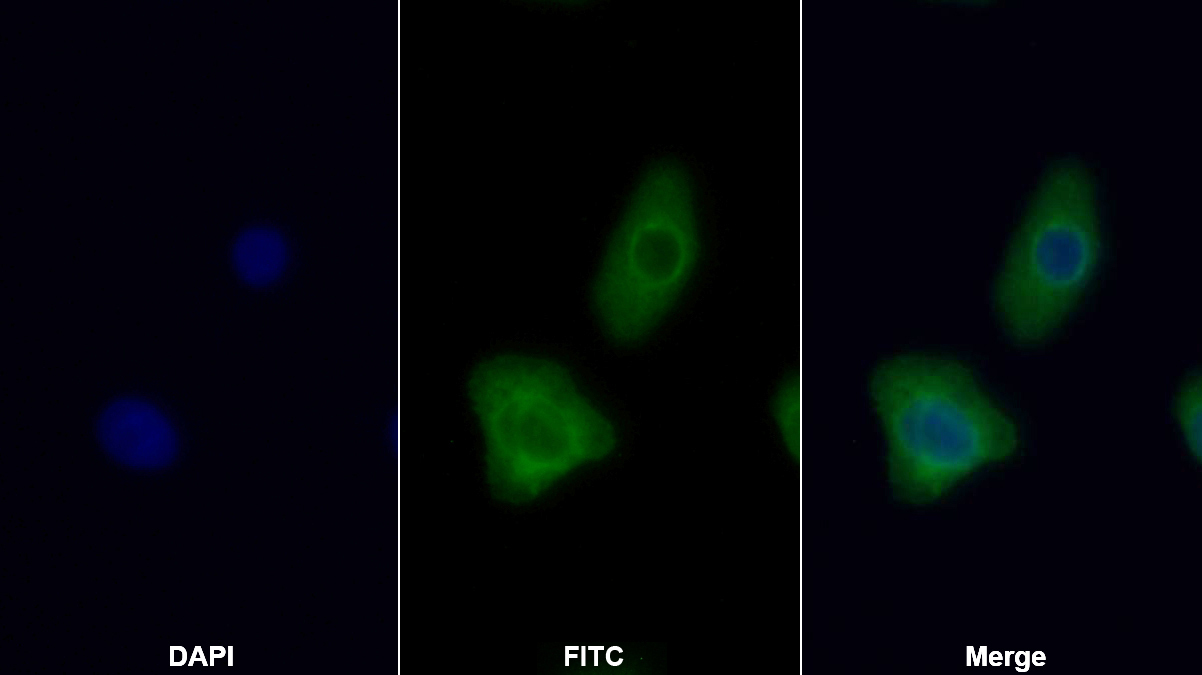 Polyclonal Antibody to Protein Kinase, AMP Activated Alpha 1 (AMPK Alpha 1)