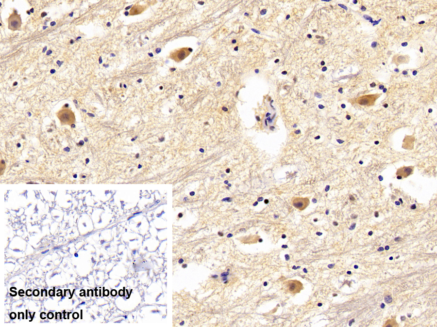 Polyclonal Antibody to Membrane Protein, Palmitoylated 2 (MPP2)