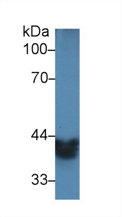 Polyclonal Antibody to Alcohol Dehydrogenase 1 (ADH1)