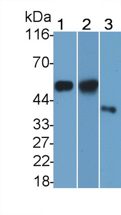 Polyclonal Antibody to Cluster Of Differentiation 14 (CD14)