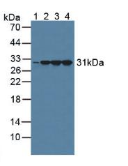 Polyclonal Antibody to Calretinin (CR)