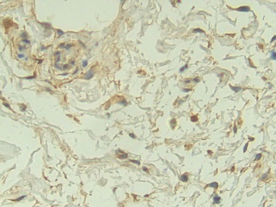 Polyclonal Antibody to Neuropilin 1 (NRP1)