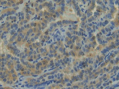 Polyclonal Antibody to Neuropilin 1 (NRP1)