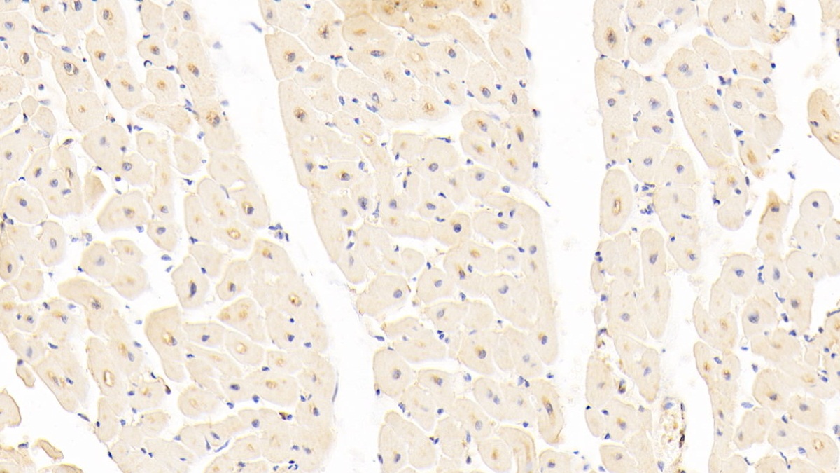 Polyclonal Antibody to Neuropilin 1 (NRP1)