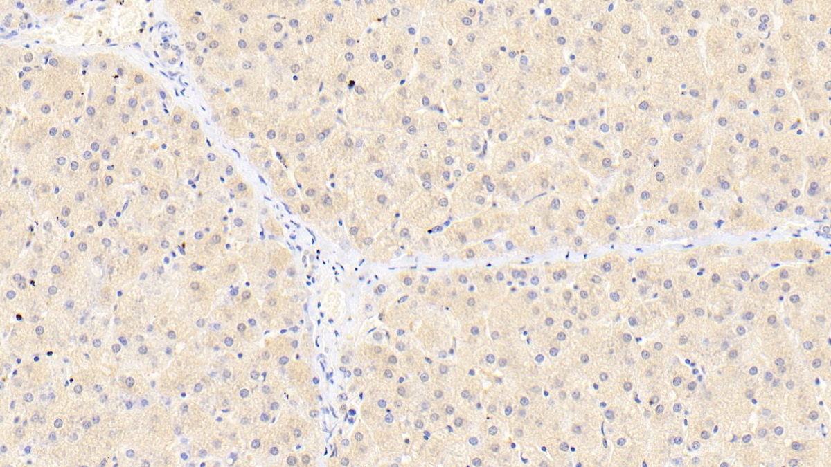 Polyclonal Antibody to Neuropilin 1 (NRP1)
