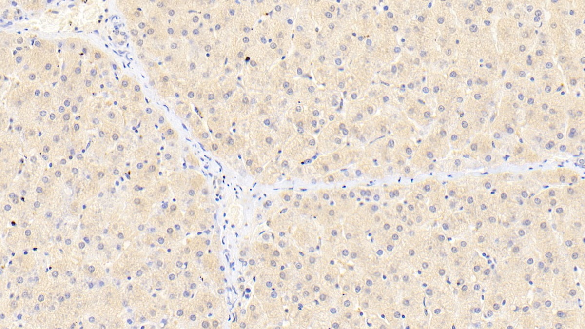 Polyclonal Antibody to Neuropilin 1 (NRP1)