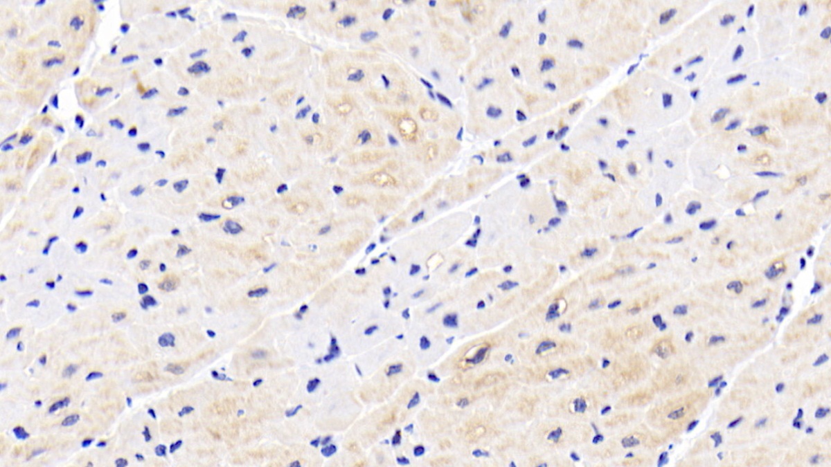 Polyclonal Antibody to Heat Shock Protein 27 (Hsp27)