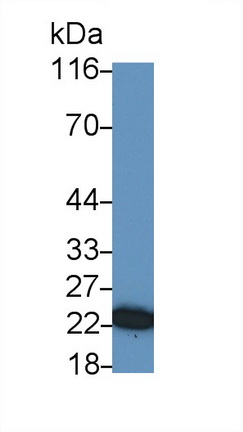 Polyclonal Antibody to Heat Shock Protein 27 (Hsp27)