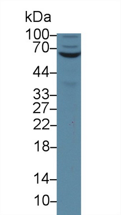 Polyclonal Antibody to Membrane Protein, Palmitoylated 6 (MPP6)