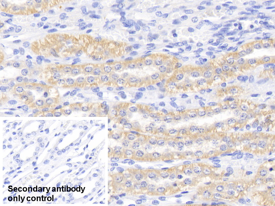 Polyclonal Antibody to Apolipoprotein E (APOE)